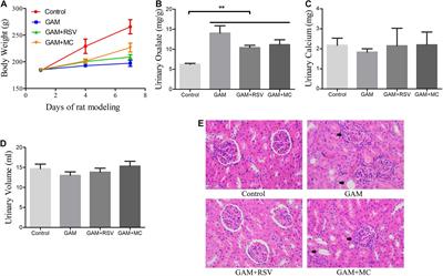 Resveratrol Attenuates Oxalate-Induced Renal Oxidative Injury and Calcium Oxalate Crystal Deposition by Regulating TFEB-Induced Autophagy Pathway